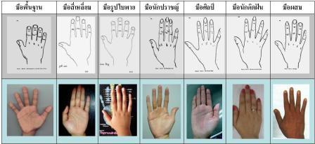 มือ 7 ประเภทมุษย์ หรือ ลักษณะมือ 7แบบ